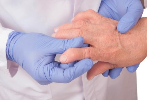 Rheumatoide Arthritis